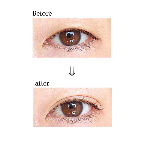 ローヤルアイム - 画像3