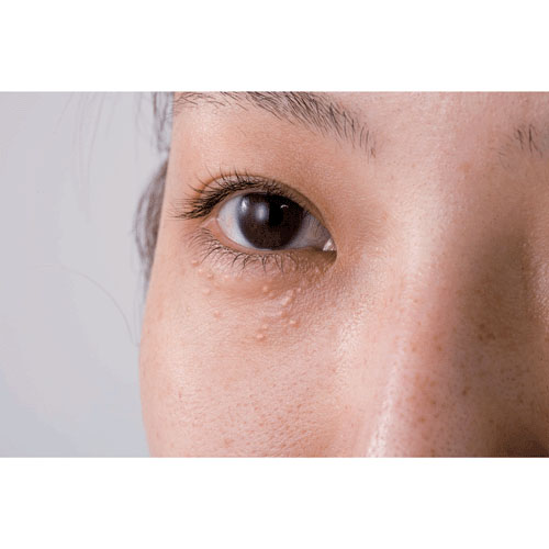 ビューナ シロポロン - 画像4